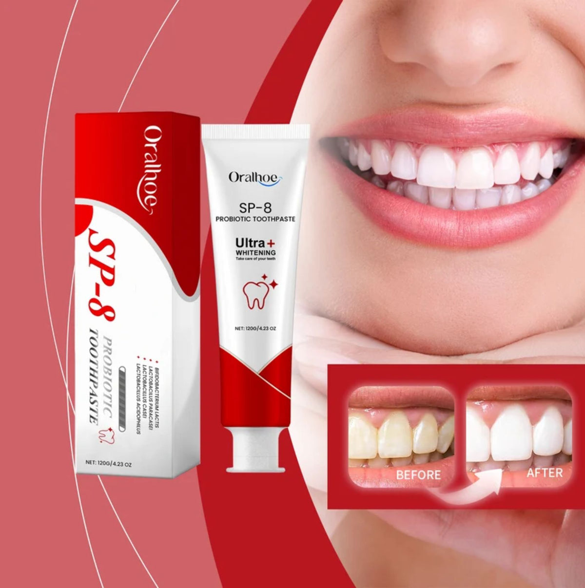 ORALHOE SP-8 Probiotic Toothpaste 120g – Whitening, Stain Removal, Deep Cleaning & Fresh Breath