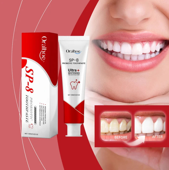 ORALHOE SP-8 Probiotic Toothpaste 120g – Whitening, Stain Removal, Deep Cleaning & Fresh Breath