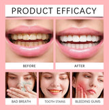 ORALHOE SP-8 Probiotic Toothpaste 120g – Whitening, Stain Removal, Deep Cleaning & Fresh Breath