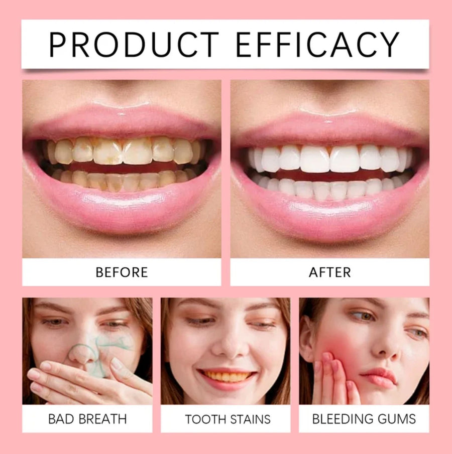 ORALHOE SP-8 Probiotic Toothpaste 120g – Whitening, Stain Removal, Deep Cleaning & Fresh Breath