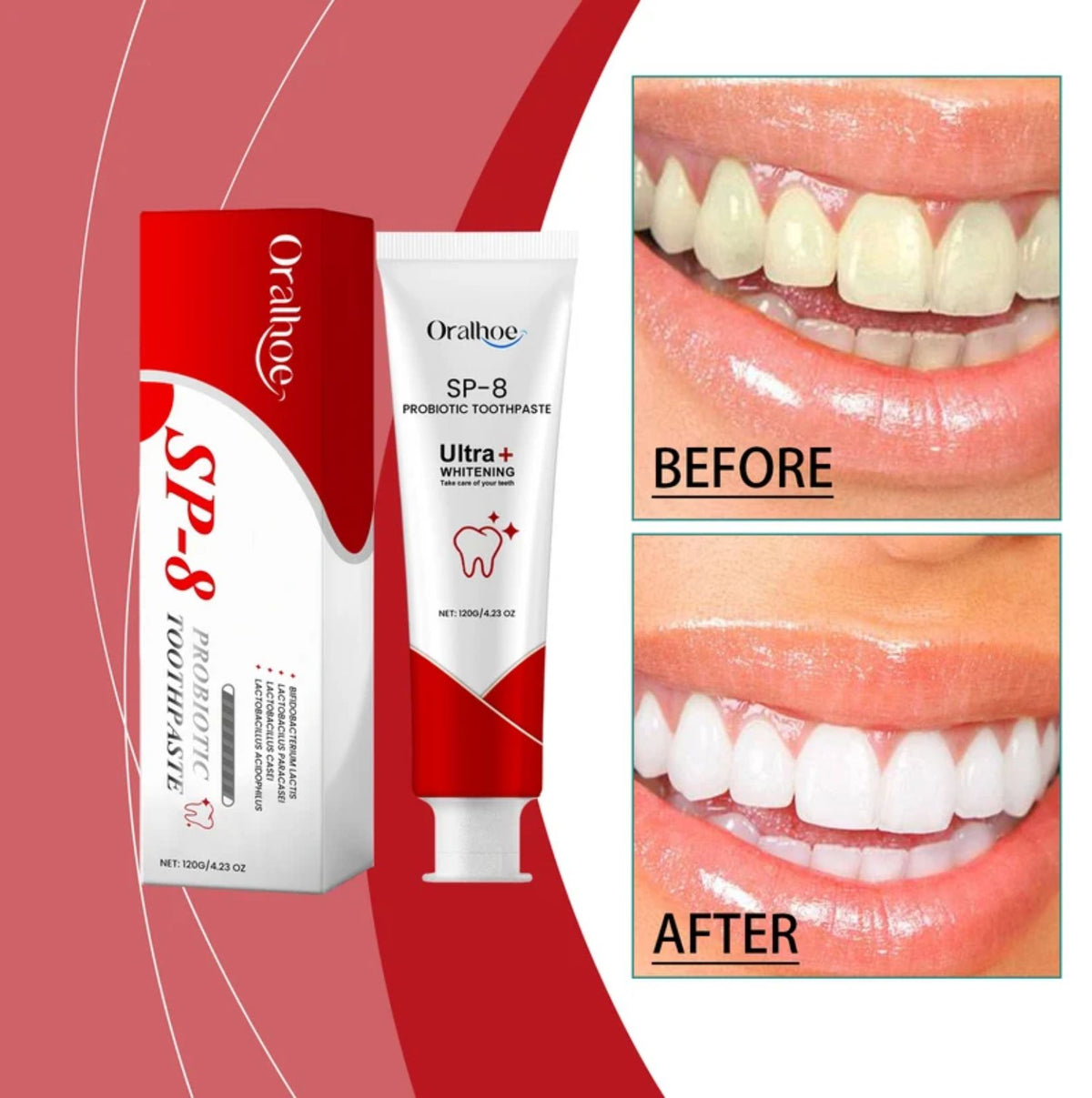 ORALHOE SP-8 Probiotic Toothpaste 120g – Whitening, Stain Removal, Deep Cleaning & Fresh Breath