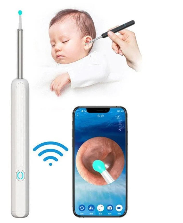 Smart Earwax Removal Kit, HD Camera, Wi-Fi & LED Ear Cleaner